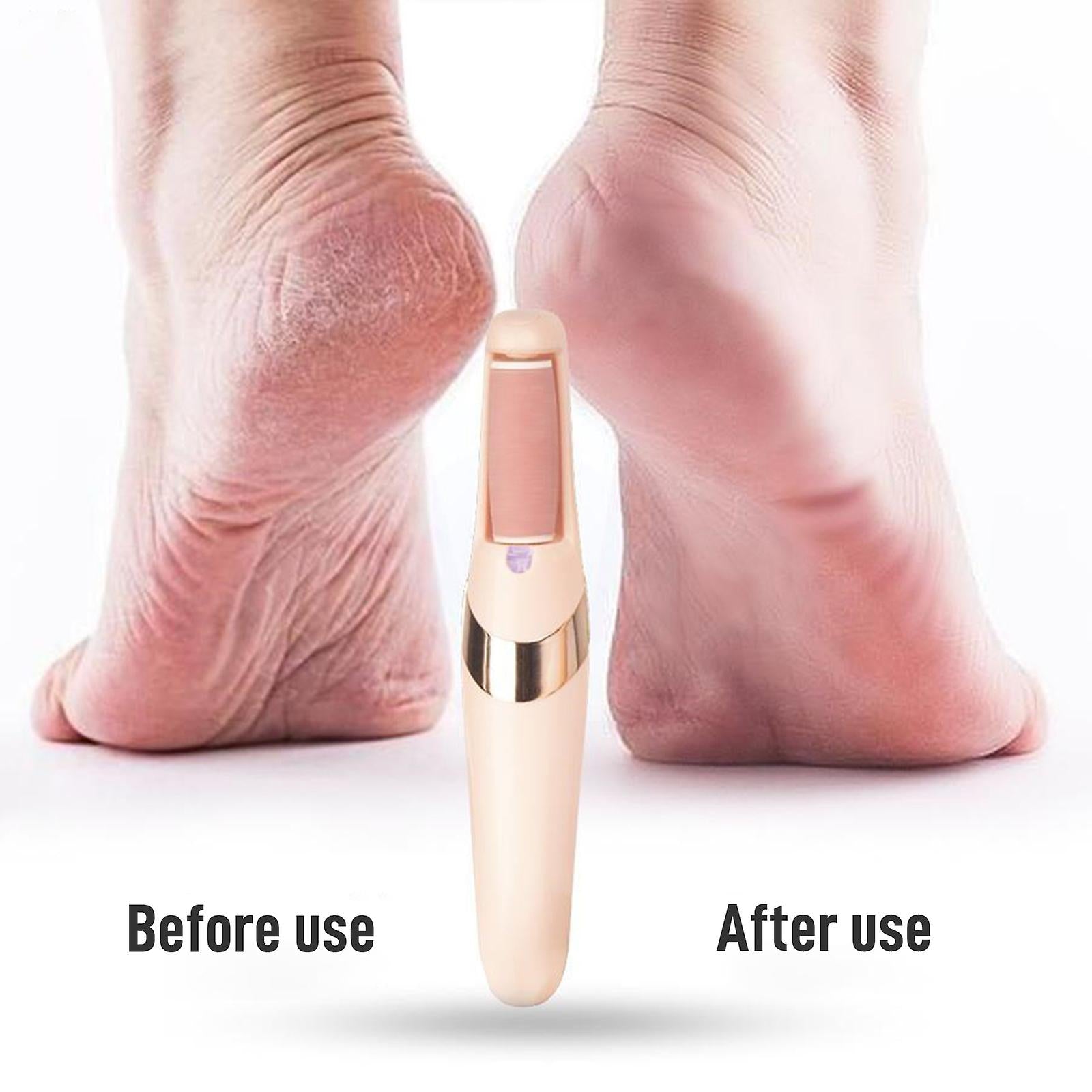 Professional Electric Foot Callus Remover