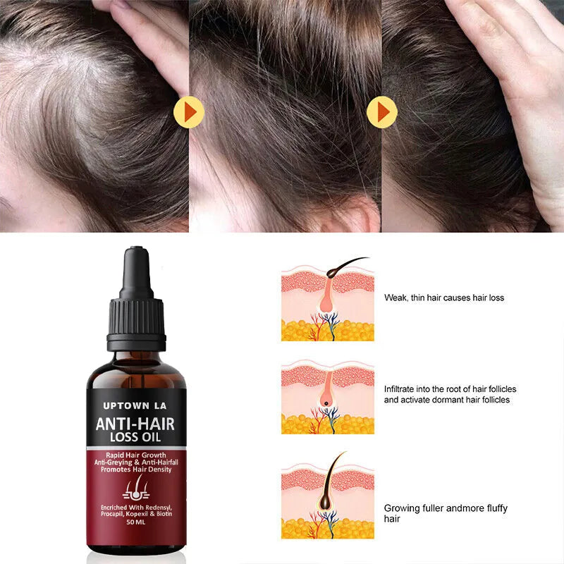 Hair Regrowth & Anti Hair Fall Oil for Men & Women