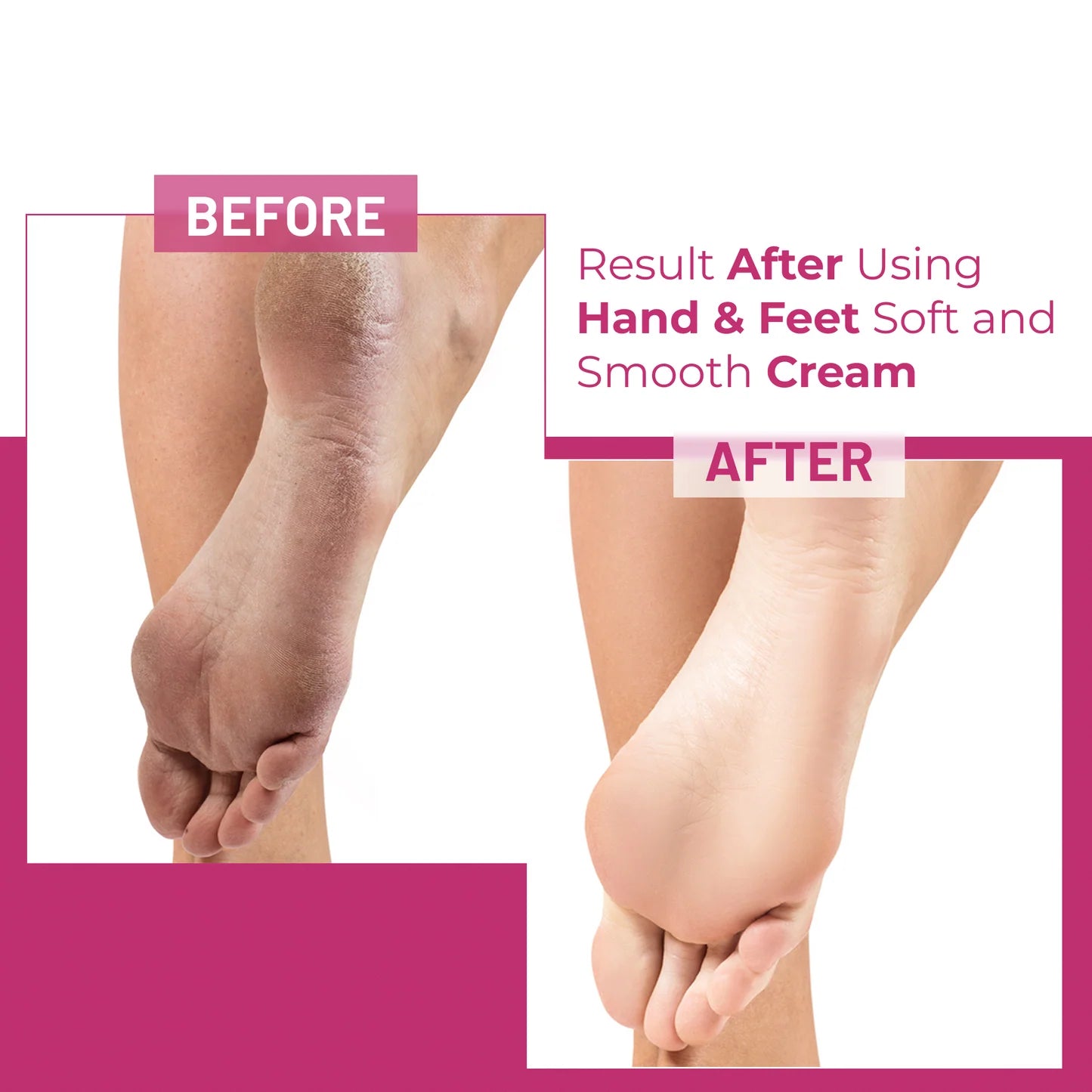 Uptown LA Hand & Feet Whitening Cream – 30ml