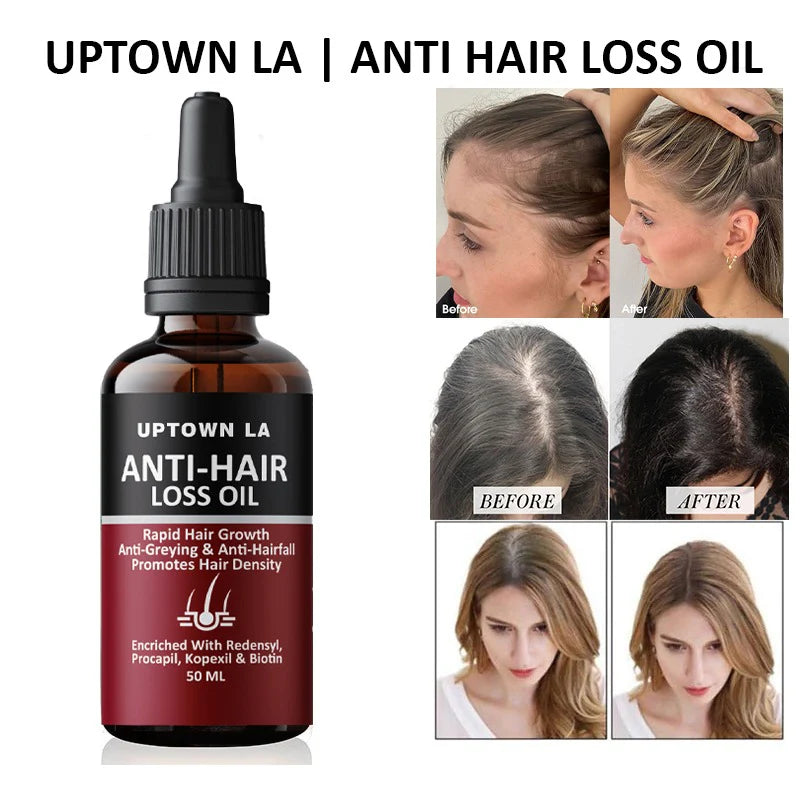 Hair Regrowth & Anti Hair Fall Oil for Men & Women