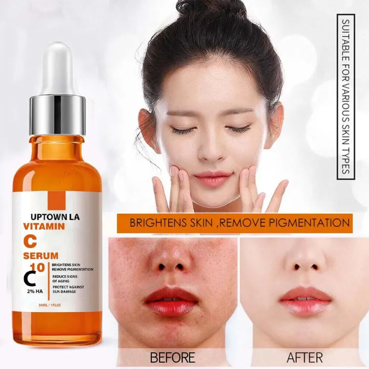 Uptown LA Vitamin C Serum for Face & Eye Area
